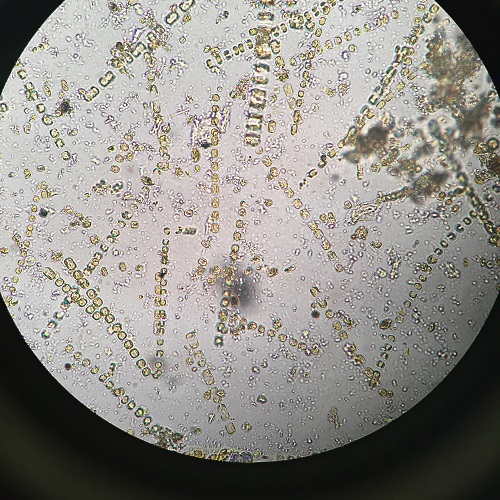 图3+显微镜下种类繁多的浮游生物.jpg